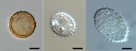  comparison of urediniospores from L-R,  P. paullula ,  U. monsterae,  and  U. monstericola ; scale bar = 10 mu;mnbsp;
